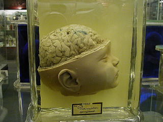 cerebro bebe